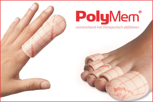 images/Casuistiek-GD-PolyMem.jpg