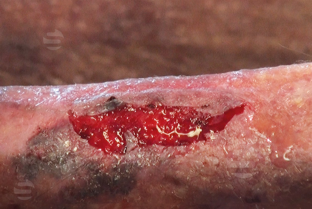images/p_skin-tear.jpg